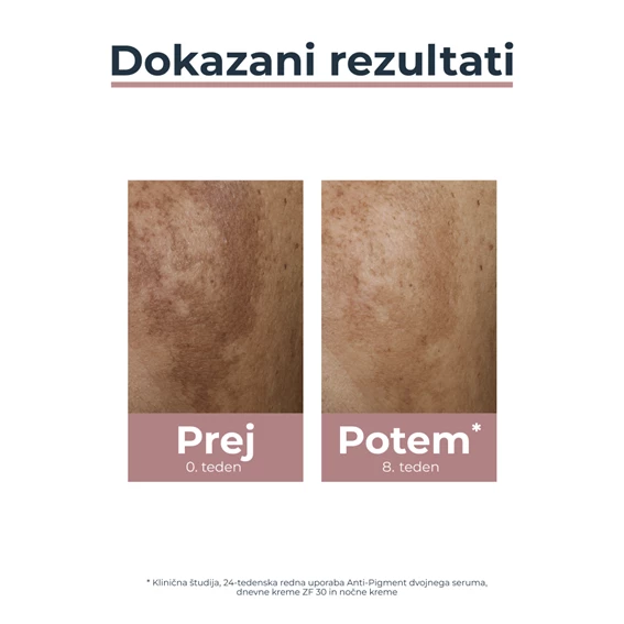 Eucerin Anti-Pigment dvojni serum, 30 ml