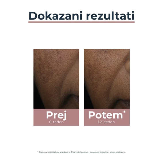 Eucerin Anti-Pigment korektor, 5 ml