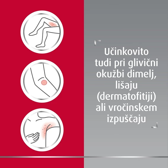 Canespor dermalno pršilo 10mg/ml, 25 ml