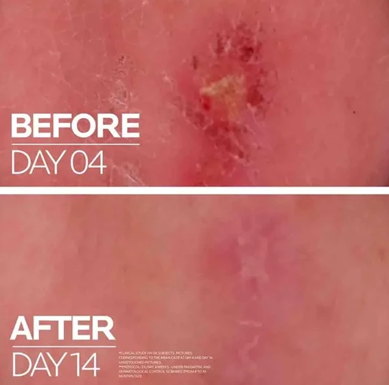 LRP Cicaplast Baume B5+ ultra obnovitveni balzam, 40 ml